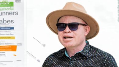 John Chiti Cautions Against Misuse of Sunscreen Among People with Albinism